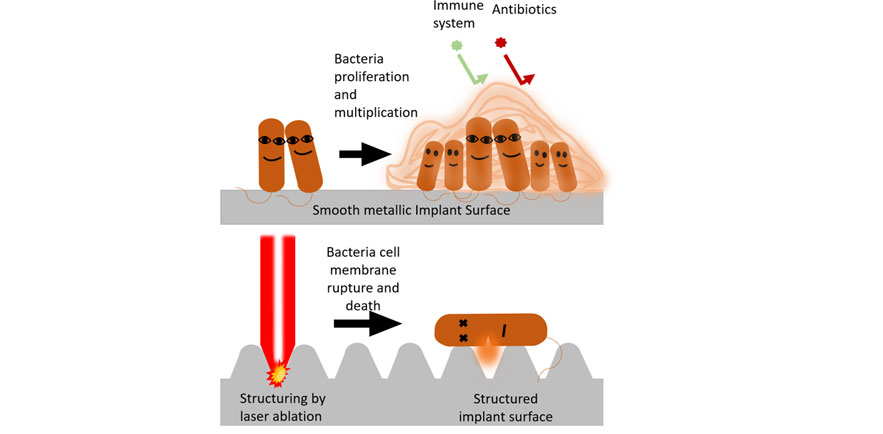 bacteria strains